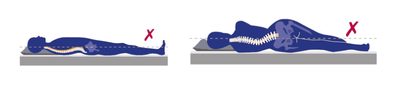 Graphics showing poor sleeping posture: on a flat surface that doesn't conform to the shape of the spine.